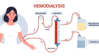 Cathéter dialyse enfants Huderf Hôpital Erasme H.U.B 