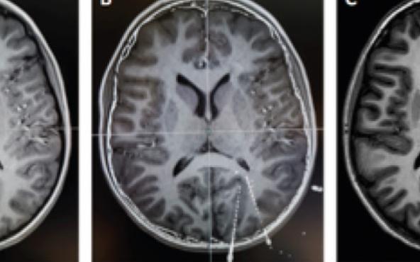 brains.jpg