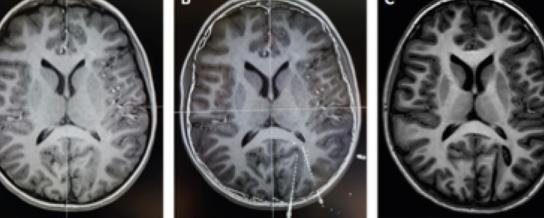 brains.jpg