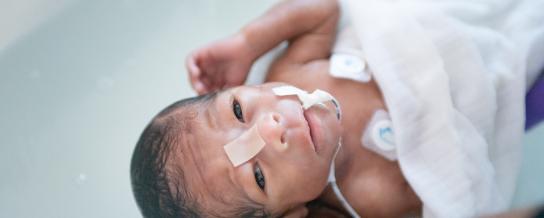 prématurité néonatologie bruxelles